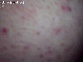 Hey, what's up with Dicknastytheillest? He's all skin, cock, and bones looking ready for some nasty creampie action!